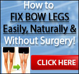 ad2 3 Bow Legs No More Program