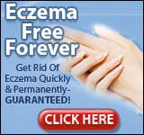 ad4 3 Eczema Free You