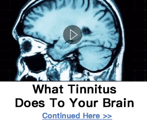 tinnitus3002501 Synapse XT Brain Supplement 2021