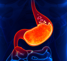 Acid Reflux – 7 Foods You Didnt Know Cause It Acid Reflux - 7 Foods You Didn't Know Cause It