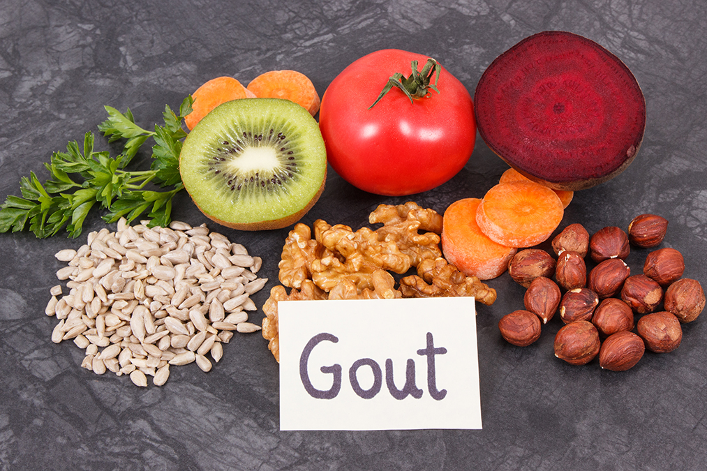 Enlarged Prostate or Gout–Your Choice Enlarged Prostate or Gout Your Choice