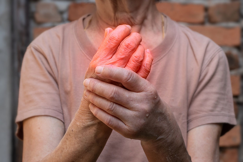 Gout And Anxiety Connection Discovered Gout and Anxiety Connection Discovered