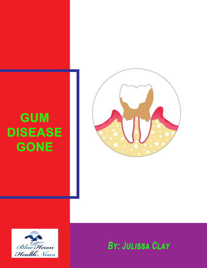 Gum Disease Gone™ Reviews Julissa Clay | Buyer Alert 2024