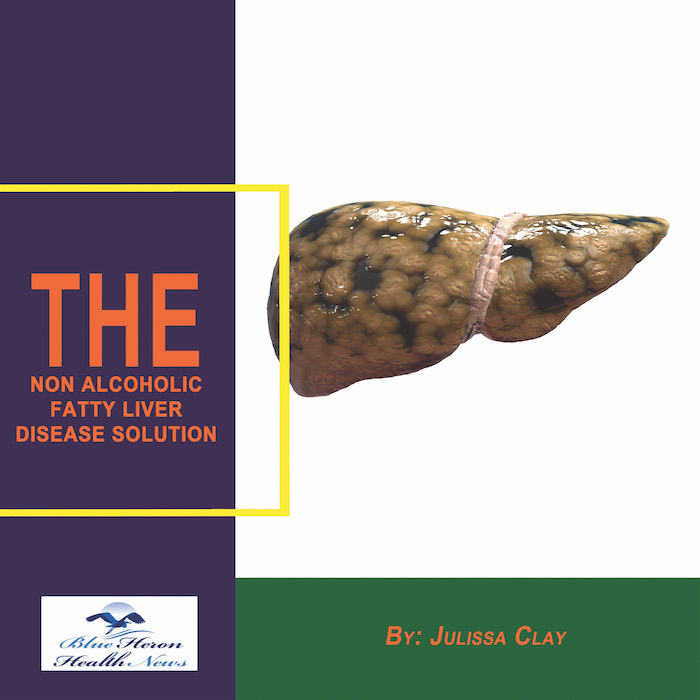 The Non Alcoholic Fatty Liver Disease Solution PDF eBook Julissa Clay